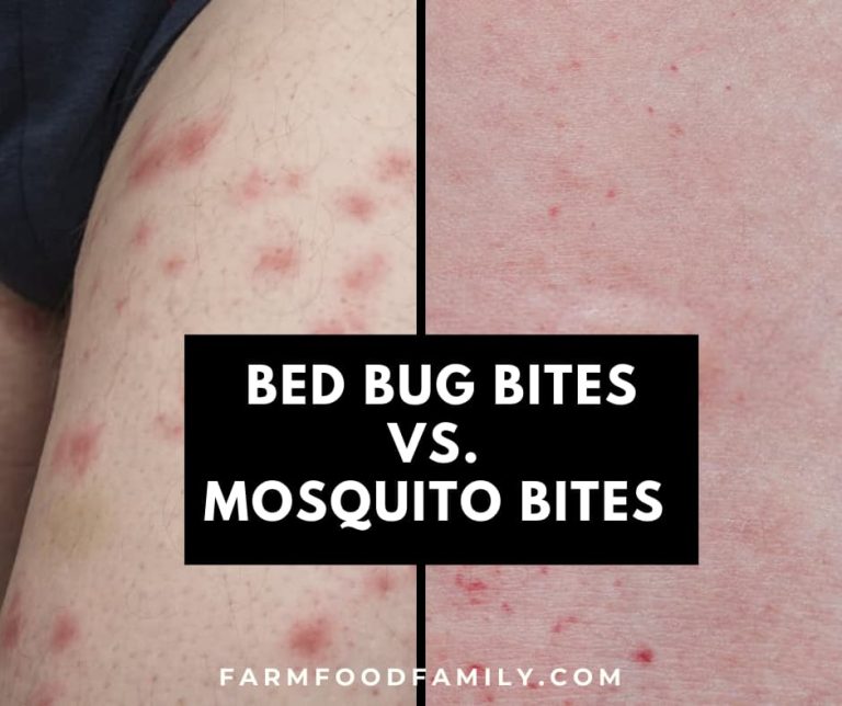 Bed Bug Bites vs. Mosquito Bites Similarities and Differences (Photos)